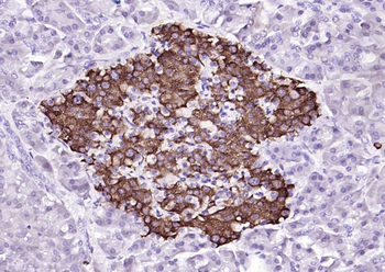 HDHD3 Rabbit Polyclonal Antibody
