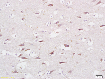 FAM40A Rabbit Polyclonal Antibody