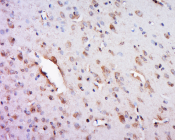 FAM113A Rabbit Polyclonal Antibody