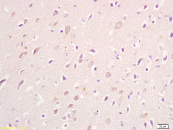 FAM21C Rabbit Polyclonal Antibody
