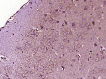 ATP6V1G2 Rabbit Polyclonal Antibody