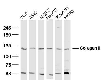 Collagen II Rabbit Polyclonal Antibody