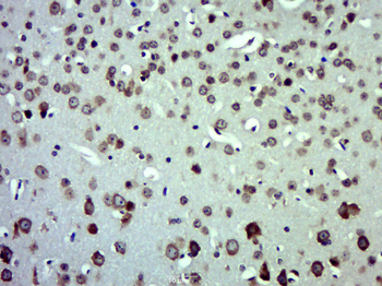 CXCL11 Rabbit Polyclonal Antibody