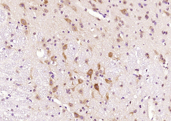 CRF1 Rabbit Polyclonal Antibody