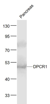 DPCR1 Rabbit Polyclonal Antibody