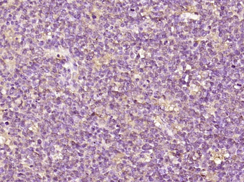 EDC4 Rabbit Polyclonal Antibody