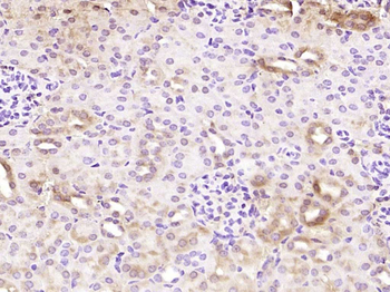EDC4 Rabbit Polyclonal Antibody
