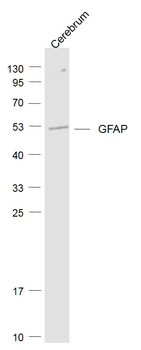 GFAP Rabbit Polyclonal Antibody