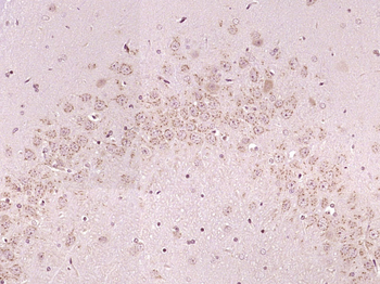 MYO16 Rabbit Polyclonal Antibody