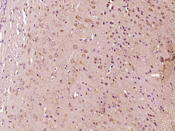 N ras + c Ha ras Rabbit Polyclonal Antibody