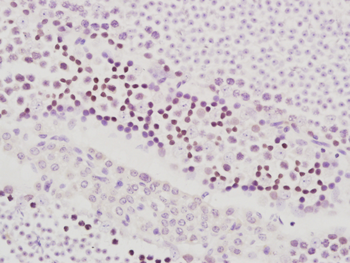 NARG1 Rabbit Polyclonal Antibody