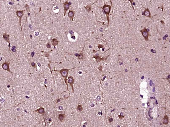 NBPF5 Rabbit Polyclonal Antibody