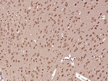 Nesprin 3 antibody