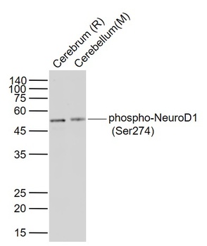 NeuroD1 (phospho-Ser274) antibody