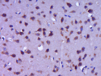 NELL1 Rabbit Polyclonal Antibody
