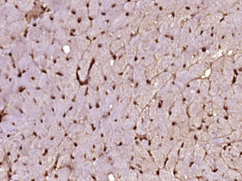 Nkx2.6 Rabbit Polyclonal Antibody