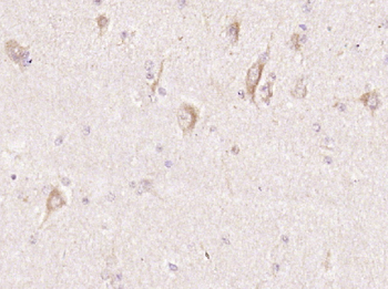 NLRC5 Rabbit Polyclonal Antibody