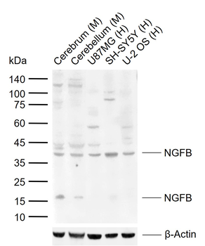 NGFB Rabbit Polyclonal Antibody