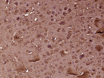 NPL4 Rabbit Polyclonal Antibody