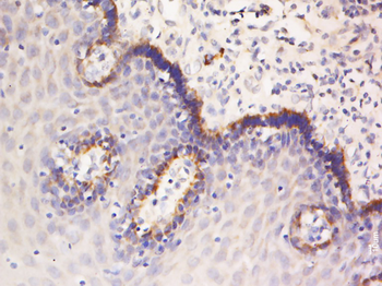 NRAP Rabbit Polyclonal Antibody