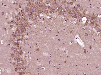 QDPR Rabbit Polyclonal Antibody