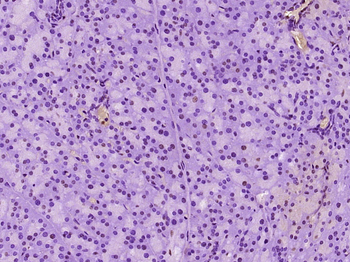 RREB1 Rabbit Polyclonal Antibody
