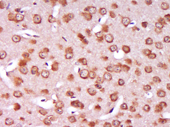 SLC27A1 Rabbit Polyclonal Antibody