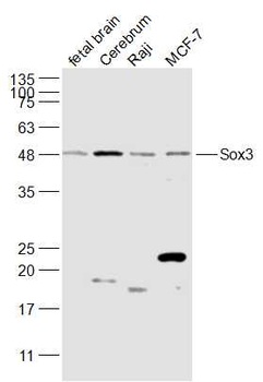 Sox3 Rabbit Polyclonal Antibody