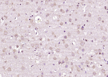 SAH3 Rabbit Polyclonal Antibody