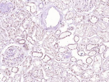 SAMD13 Rabbit Polyclonal Antibody