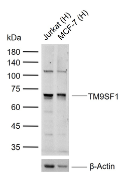 TM9SF1 Rabbit Polyclonal Antibody