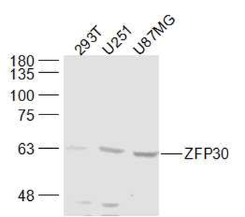 ZFP30 Rabbit Polyclonal Antibody