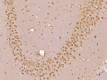 ZFP64 Rabbit Polyclonal Antibody