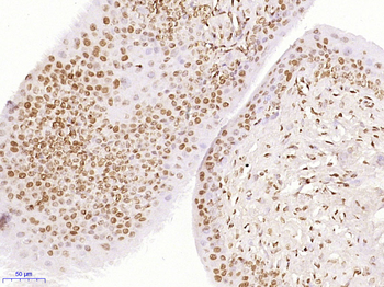 ZFP64 Rabbit Polyclonal Antibody