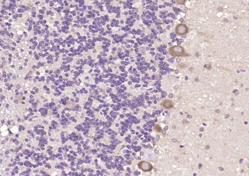 FRMD4B Rabbit Polyclonal Antibody