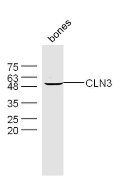 CLN3 Rabbit Polyclonal Antibody