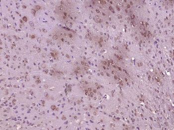 CKLFH8 Rabbit Polyclonal Antibody