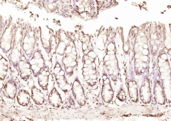 CLLD8 Rabbit Polyclonal Antibody