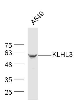 KLHL3 Rabbit Polyclonal Antibody