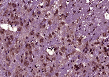 KIAA1199 Rabbit Polyclonal Antibody