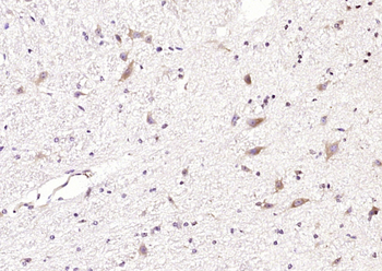 CCDC50 Rabbit Polyclonal Antibody