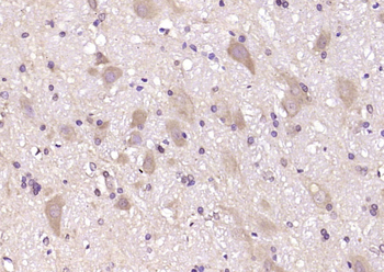 CCDC134 Rabbit Polyclonal Antibody