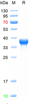 Recombinant human PAPPA protein, N-His