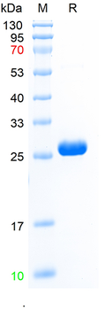 Recombinant human GSTP1 protein, N-His