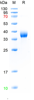 Recombinant human Integrin Alpha V + Beta 3 (CD51+CD61) protein, N-His