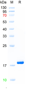 Recombinant mouse IL21 protein, N-His