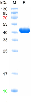 Recombinant HRSVA Nucleoprotein protein, N-His