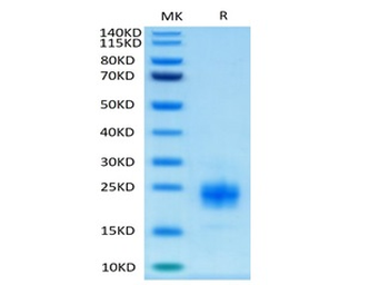 Recombinant human TIGIT protein, C-His-Avi (HEK293), Biotin conjugated