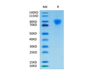 Recombinant human PDGFRA protein, C-His-Avi (HEK293), Biotin conjugated