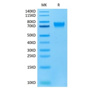 Recombinant human IL-6R protein, C-His-Avi (HEK293), Biotin conjugated